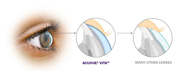 Monthly-Acuvue-Vita-Astigmatism